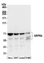 SRPRA/SRPR Polyclonal Antibody