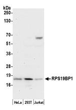 RPS19BP1/AROS Polyclonal Antibody