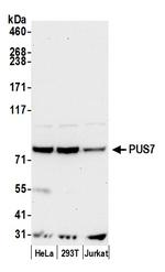 PUS7 Polyclonal Antibody