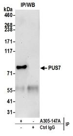 PUS7 Polyclonal Antibody