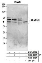 SPATS2L Polyclonal Antibody