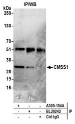 CMSS1/C3orf26 Polyclonal Antibody