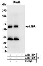 LTBR/Lymphotoxin-beta Receptor Antibody in Immunoprecipitation (IP)