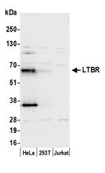 LTBR/Lymphotoxin-beta Receptor Polyclonal Antibody