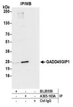 GADD45GIP1/CRIF1 Antibody in Immunoprecipitation (IP)