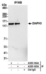 DIAPH3 Antibody in Immunoprecipitation (IP)