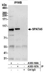 SPATA5 Polyclonal Antibody