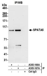 SPATA5 Polyclonal Antibody