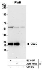 CD3D Antibody in Immunoprecipitation (IP)
