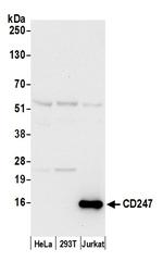 CD247/CD3Z Antibody in Western Blot (WB)