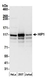 HIP1/Huntingtin-interacting Protein 1 Polyclonal Antibody
