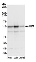 HIP1/Huntingtin-interacting Protein 1 Polyclonal Antibody