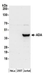 ADA/Adenosine Deaminase Polyclonal Antibody