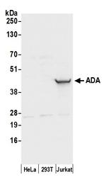ADA/Adenosine Deaminase Polyclonal Antibody