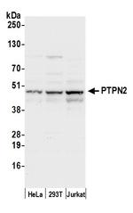PTPN2/TCPTP Polyclonal Antibody