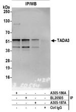 TADA3/TADA3L Polyclonal Antibody