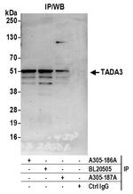 TADA3/TADA3L Polyclonal Antibody
