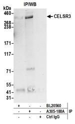 CELSR3/Flamingo Homolog 1 Polyclonal Antibody
