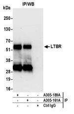 LTBR/Lymphotoxin-beta Receptor Antibody in Immunoprecipitation (IP)