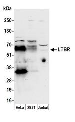 LTBR/Lymphotoxin-beta Receptor Polyclonal Antibody