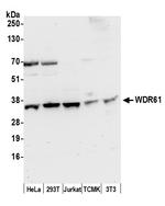 WDR61/REC14/SKI8 Polyclonal Antibody