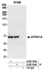 ATP6V1A Polyclonal Antibody