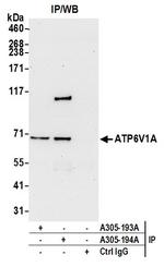 ATP6V1A Antibody in Immunoprecipitation (IP)