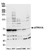 ATP6V1A Polyclonal Antibody