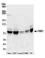 FMR1/FMRP Polyclonal Antibody