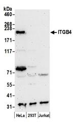 ITGB4/CD104/Integrin beta-4 Polyclonal Antibody