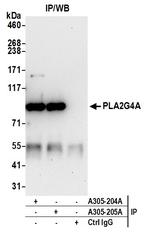 PLA2G4A/cPLA2 Polyclonal Antibody