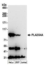 PLA2G4A/cPLA2 Polyclonal Antibody