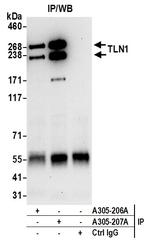 TLN1/Talin-1 Antibody in Immunoprecipitation (IP)