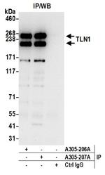 TLN1/Talin-1 Antibody in Immunoprecipitation (IP)