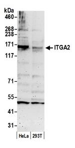 ITGA2/CD49B/Integrin alpha-2 Antibody in Western Blot (WB)