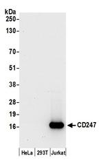 CD247/CD3Z Antibody in Western Blot (WB)