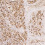 ACTR2/ARP2 Polyclonal Antibody