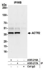 ACTR2/ARP2 Antibody in Immunoprecipitation (IP)