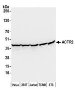ACTR2/ARP2 Antibody in Western Blot (WB)