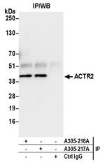 ACTR2/ARP2 Antibody in Immunoprecipitation (IP)