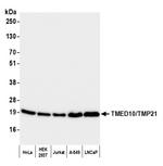 TMED10/TMP21 Polyclonal Antibody