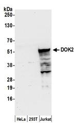 DOK2 Polyclonal Antibody