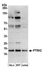 PTRH2/BIT1 Polyclonal Antibody