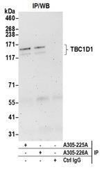 TBC1D1 Antibody in Immunoprecipitation (IP)