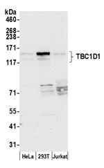 TBC1D1 Polyclonal Antibody