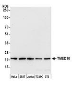 TMED10/TMP21 Polyclonal Antibody