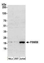 PSMB8/LMP7 Polyclonal Antibody