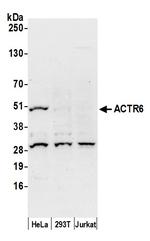 ACTR6 Polyclonal Antibody
