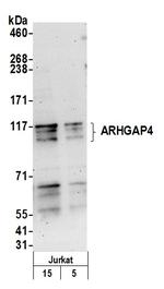 ARHGAP4 Polyclonal Antibody