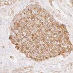 ANXA1/Annexin A1 Antibody in Immunohistochemistry (Paraffin) (IHC (P))
